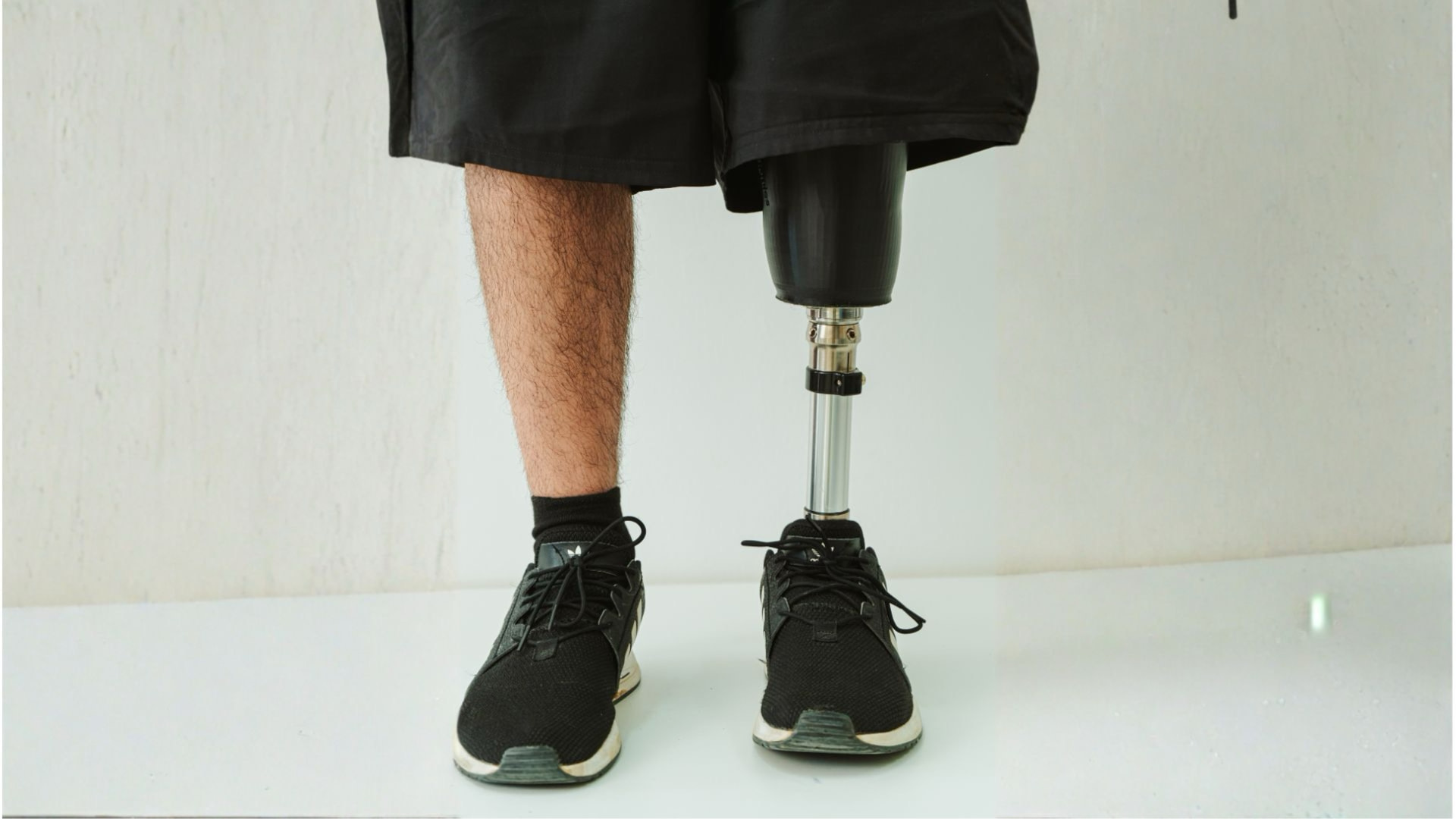 Person standing with a Cure Bionics lower limb prosthesis