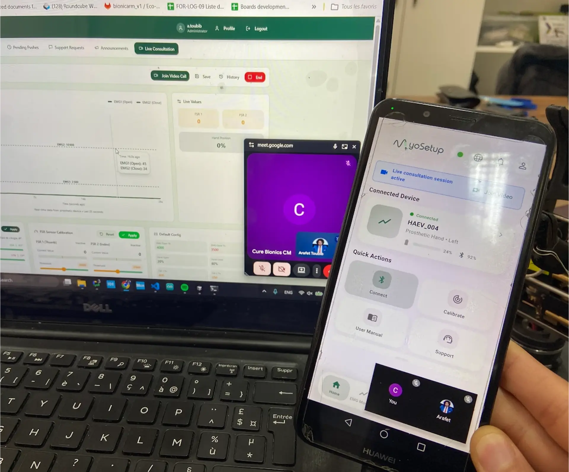 MyoSetup remote consultation connecting a mobile prosthesis app with a clinician dashboard