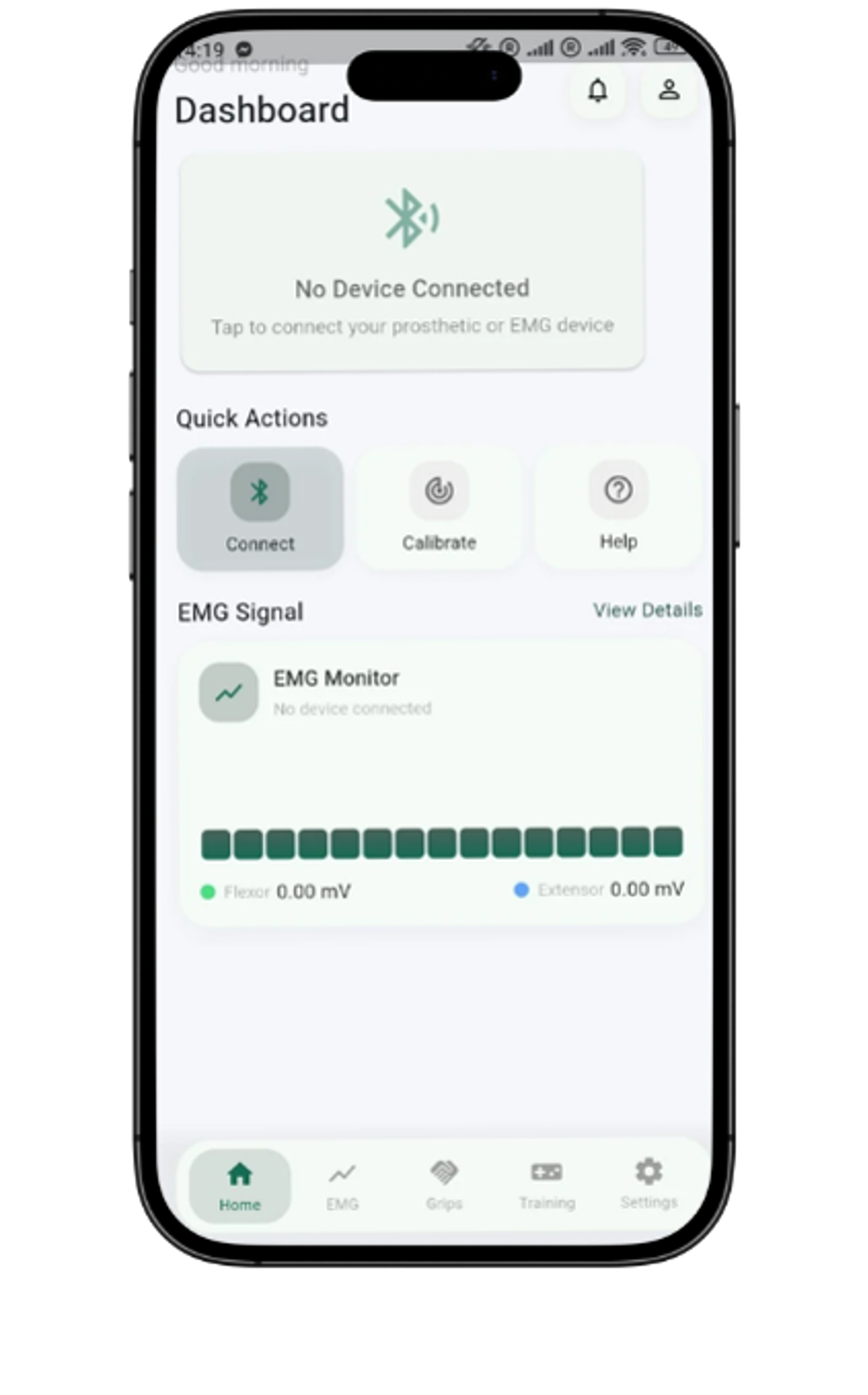 MyoSetup mobile dashboard with prosthetic connection and EMG monitoring