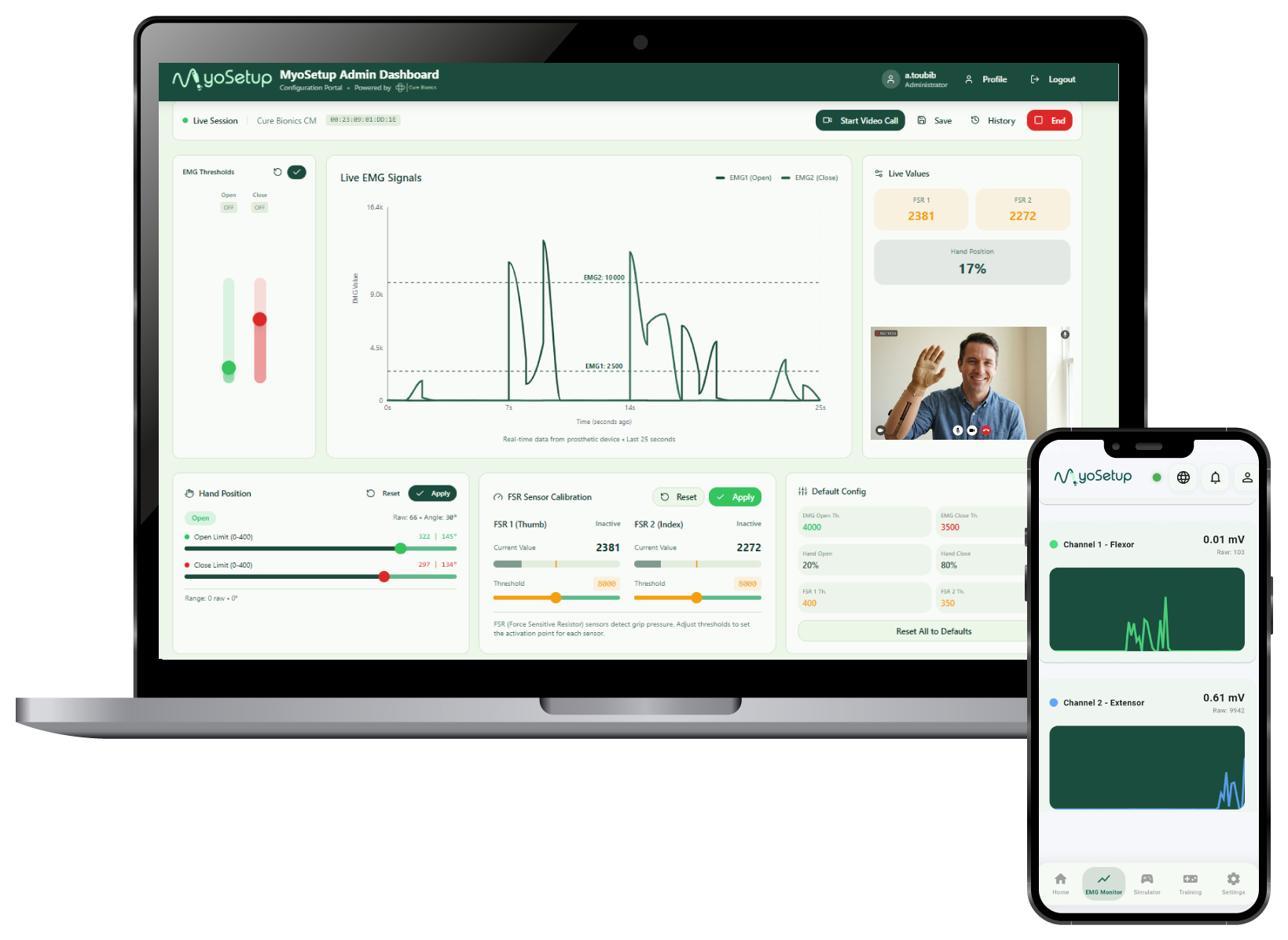 MyoSetup clinical web dashboard and mobile EMG monitor