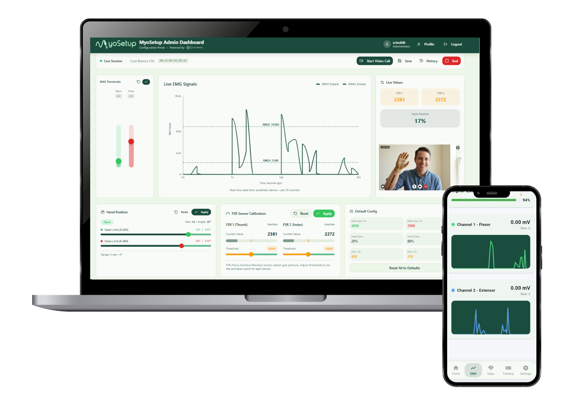 MyoSetup configuration dashboard with live EMG signals on a laptop and the MyoSense mobile app