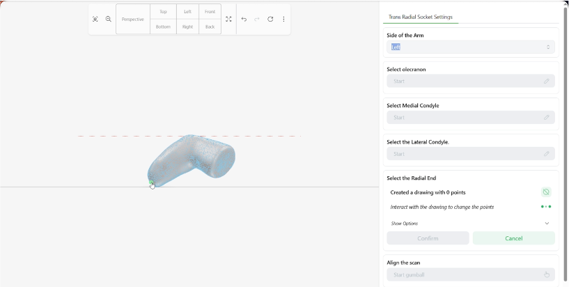 Studio de conception : alignement guidé et repères anatomiques sur le scan