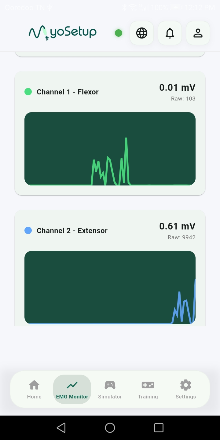 Suivi EMG en direct